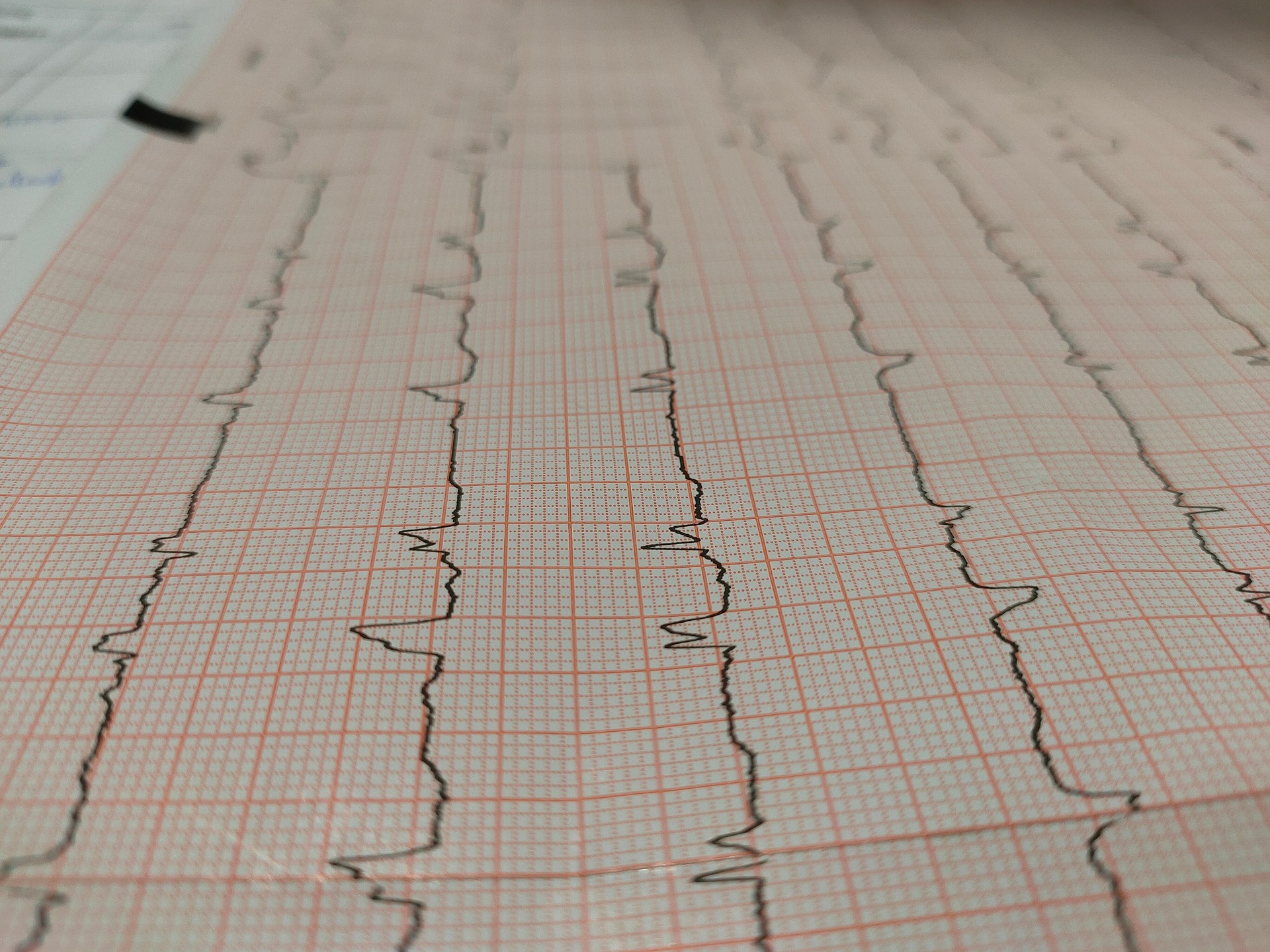 Eletrocardiograma impresso em papel quadriculado